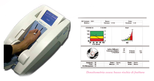 La densitometria in farmacia